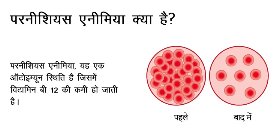 पल्स एनीमिया अभियान जनपद में 03 फरवरी से 10 फरवरी तक चलाया जायेगा